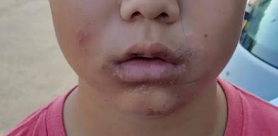 ÿ���˶�����â���^��� ��â���^������Ϣ��