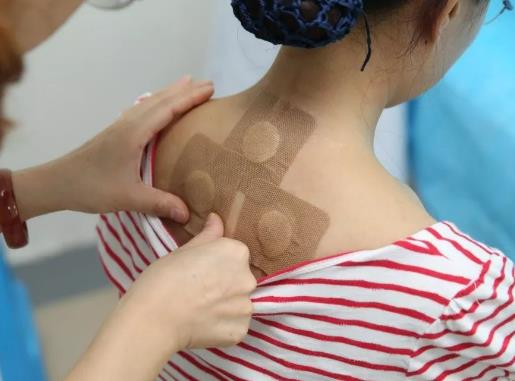 三伏貼隔一天貼一次可以嗎?三伏貼不能超過幾小時使用 三伏貼隔一天貼一次可以嗎?三伏貼不能超過幾小時使用