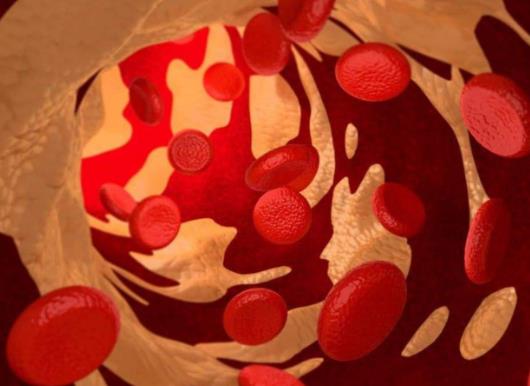 晚上睡覺血氧88正常嗎?血氧瞬間80然后馬上恢復正常要緊嗎 晚上睡覺血氧88正常嗎?血氧瞬間80然后馬上恢復正常要緊嗎