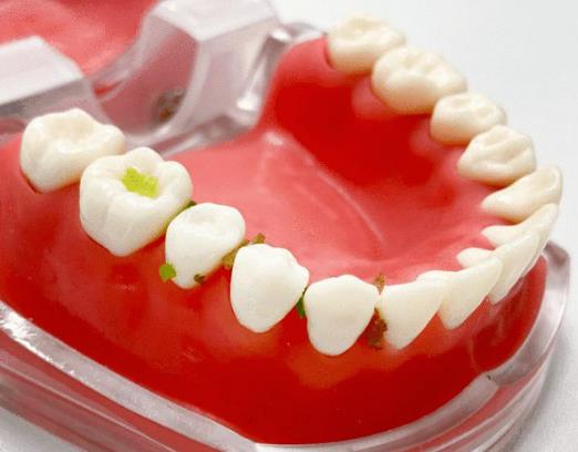 �l�¹���Ҫ����ʳ���죿�l�¹�����ÿ������Ҫ����