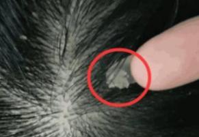 �^Ƥ�W�������Ϻ�ˎ��ϴ�^�����^�������x�İY��