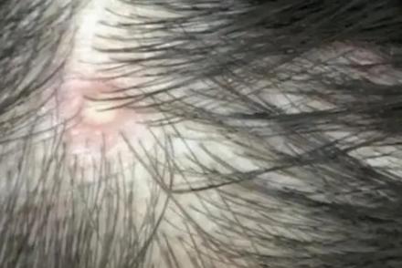 硫磺皂多久洗一次頭 為什么不可以用藥皂洗頭 硫磺皂多久洗一次頭 為什么不可以用藥皂洗頭