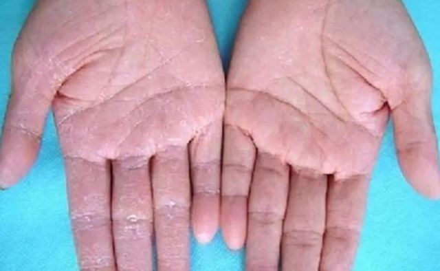 �ְ_��ʲôԭ������� ���ְ_��ʲôԭ��