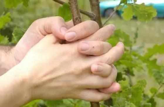 為什么會得水皰型手癬 水皰型手癬怎么根治 為什么會得水皰型手癬 水皰型手癬怎么根治