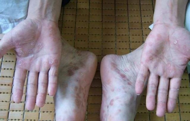 ����_���F(xi��n)��ʲô �ô׼��}���_�ĺ�̎��ʲô��