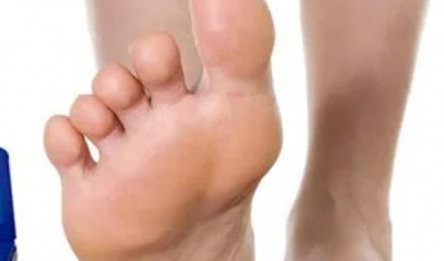 ����_���F��ʲô�Y�� ����_����Щ���Y