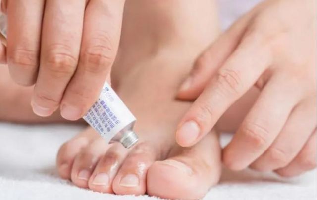 體癬的并發(fā)癥有什么 體癬是什么樣子的 體癬的并發(fā)癥有什么 體癬是什么樣子的