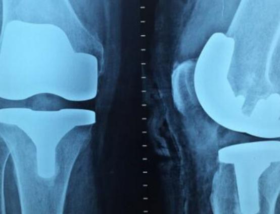 ����ʮ��żȻ�l(f��)��������ըˎ��������F�İl(f��)�����ǂ�����