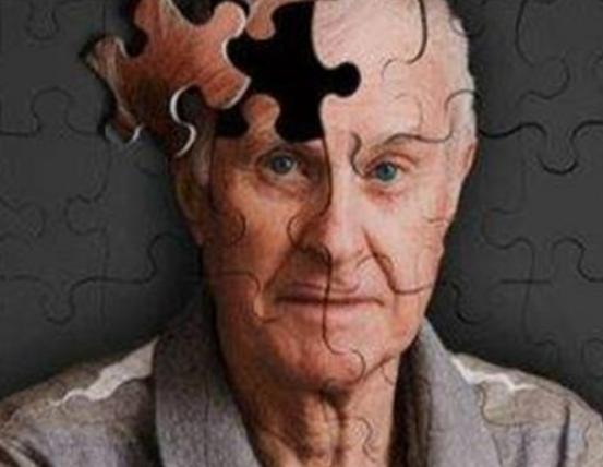 世界十大治不愈的病,慢性疲勞綜合癥、自身免疫失調(diào)都是慢性難治療 世界十大治不愈的病,慢性疲勞綜合癥、自身免疫失調(diào)都是慢性難治療