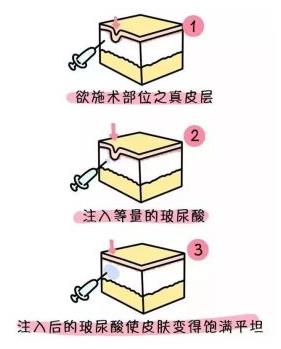 ����������ԓ�x�N�l���C�����g߀�ǲ����᣿�����ֲ�ʿ���V�㣡