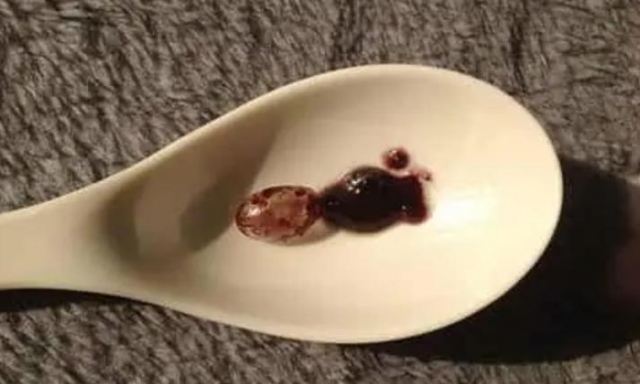 吃了幾天葡萄籽臉變黑了 吃葡萄籽十來天感覺皮膚好了 吃了幾天葡萄籽臉變黑了 吃葡萄籽十來天感覺皮膚好了