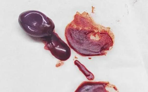 央視曝光葡萄籽了嗎 吃葡萄籽膠囊會不會變黑 央視曝光葡萄籽了嗎 吃葡萄籽膠囊會不會變黑