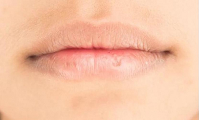 ���ܰl(f��)�S��ʲôԭ�� �촽�܇��l(f��)�S��ʲô���}