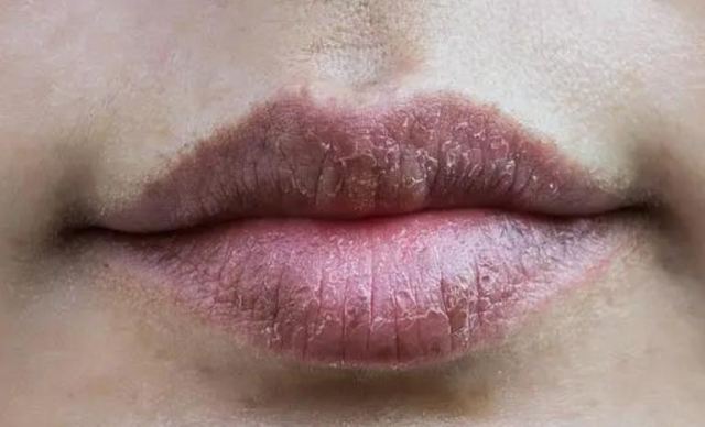 ���ܰl�S��ʲôԭ�� �촽�܇��l�S��ʲô���}