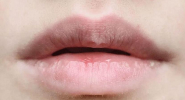 �촽�l(f��)�S��ʲô�� �����L����ʲôԭ�������