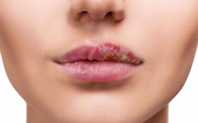 �촽���ѳԾS����CƬ��Ч�᣿�����촽������ô�k