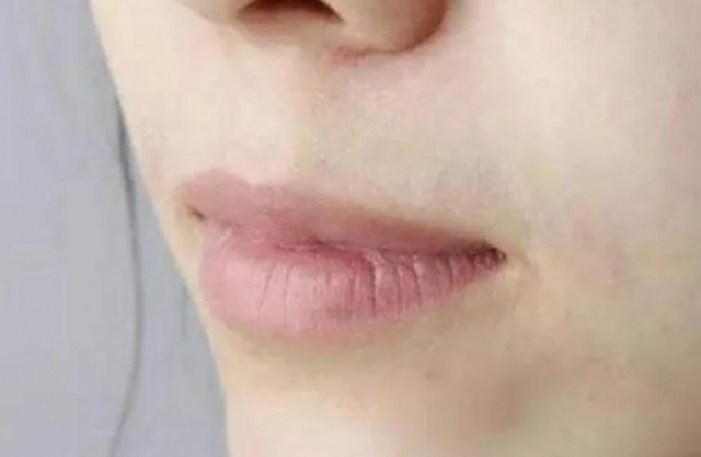 �촽���ѳԾS����CƬ��Ч������(j��ng)���촽������ô�k