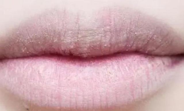 �촽����͑Ƥ��ô�k �촽����ÓƤͿʲô��