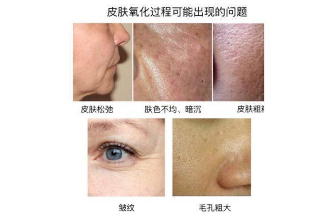 女性吃堅果能幫助抗衰老嗎 堅果的抗衰老作用大不大 女性吃堅果能幫助抗衰老嗎 堅果的抗衰老作用大不大