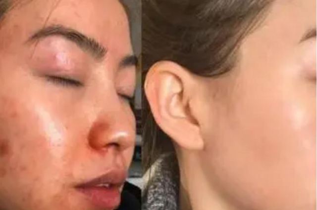 番茄有抗氧化作用嗎 番茄怎么吃抗氧化效果最好 番茄有抗氧化作用嗎 番茄怎么吃抗氧化效果最好