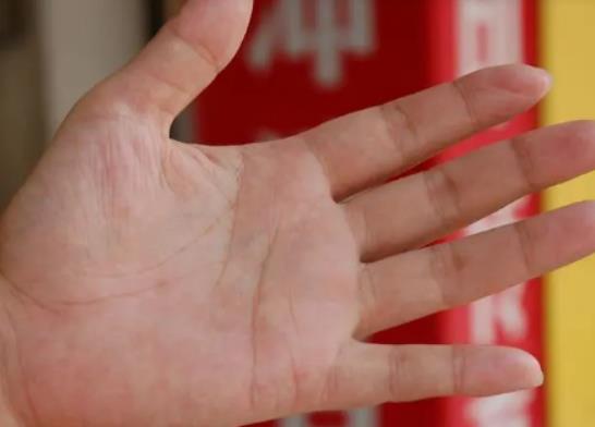 手指被自己掰粗了可以恢復嗎?掰手指關節響有沒有危害 手指被自己掰粗了可以恢復嗎?掰手指關節響有沒有危害