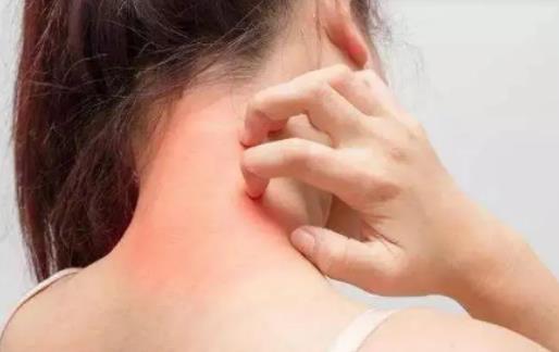 哪些人容易肌膚缺水?全身皮膚干燥是缺什么 哪些人容易肌膚缺水?全身皮膚干燥是缺什么