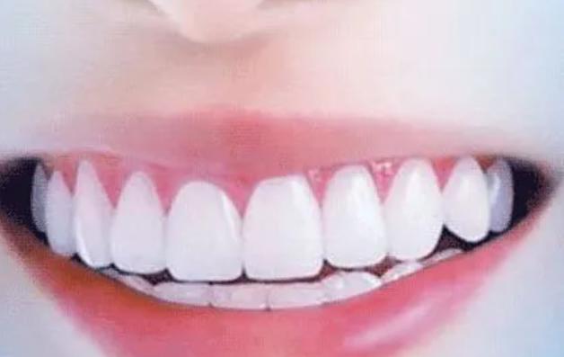 牙疼會不會引起食欲不振全身無力的癥狀?牙痛臉腫是怎么回事 牙疼會不會引起食欲不振全身無力的癥狀?牙痛臉腫是怎么回事