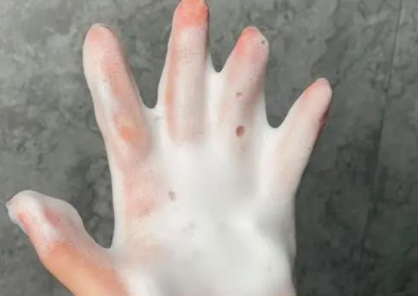 臉上頭上出油特別多怎么回事 油性皮膚和臉特別愛出油有關系嗎 臉上頭上出油特別多怎么回事 油性皮膚和臉特別愛出油有關系嗎