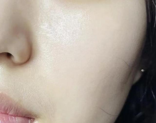 臉油頭發油是濕氣重嗎 臉出油和脾胃有關系嗎 臉油頭發油是濕氣重嗎 臉出油和脾胃有關系嗎