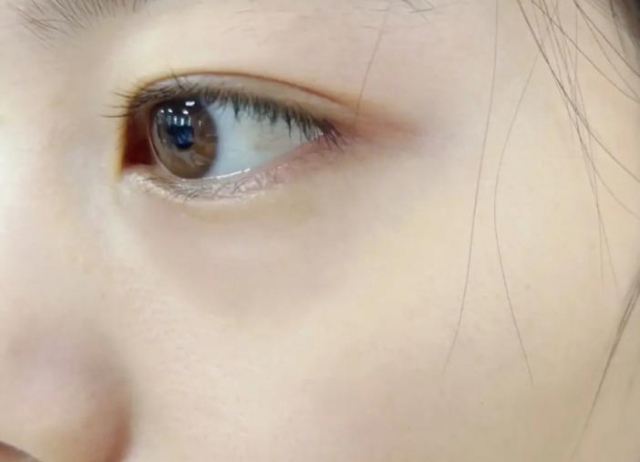 夏天臉特別愛出油怎么辦 臉愛出油可以調理嗎 夏天臉特別愛出油怎么辦 臉愛出油可以調理嗎