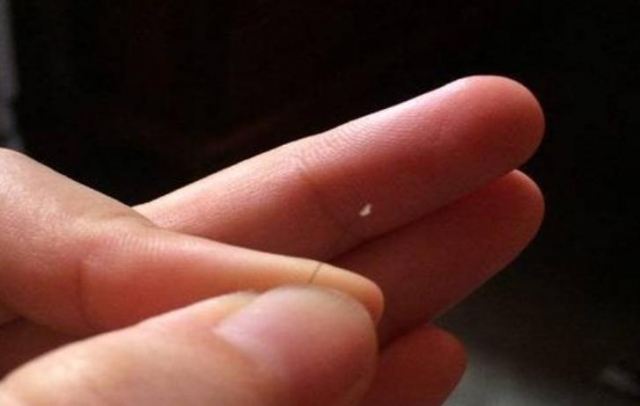 毛囊損傷是什么癥狀 毛囊損傷可以恢復嗎 毛囊損傷是什么癥狀 毛囊損傷可以恢復嗎