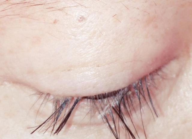 睫毛掉了會不會重新長出來 掉眼睫毛是什么原因 睫毛掉了會不會重新長出來 掉眼睫毛是什么原因