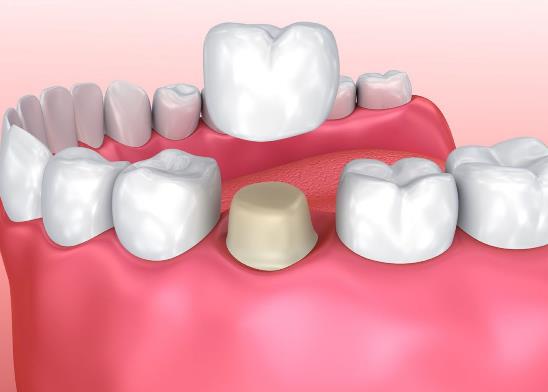 ���X�Ʉ���ʹ��ʲôԭ�������X�Ʉӳ�ʲôˎ���X