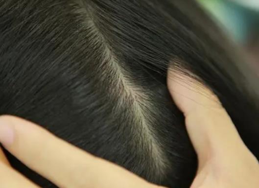 ���^���Ƀ��������^�Wô����ʲô�����^Ƥ�؄e�W���첻�Wզ�ί�