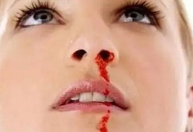 ����(ji��)������Ѫ��ʲôԭ�� ��������Ѫ��ô�k