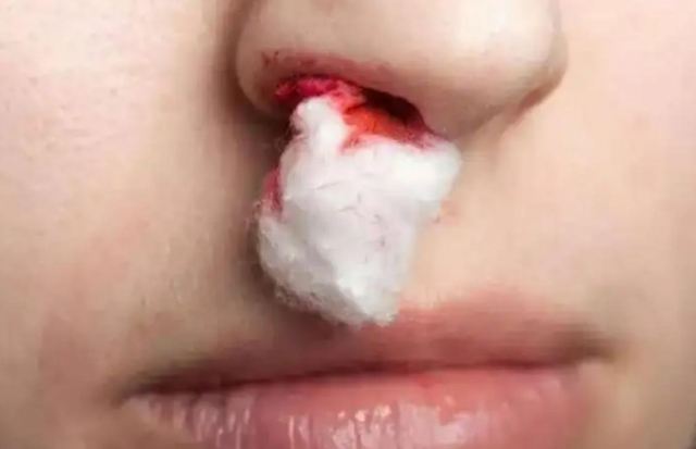 �����ϻ�Y��ԓ��ô�k ������ѪֹѪ��������Щ