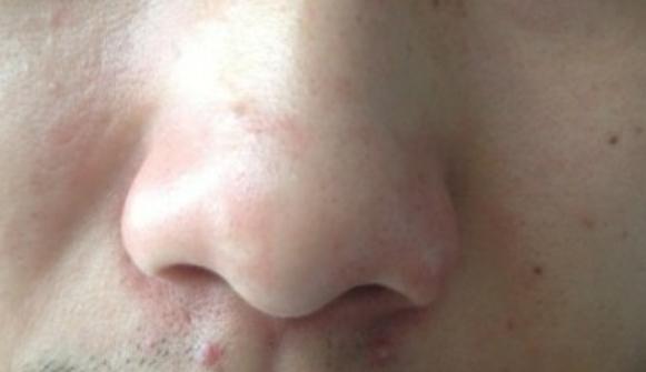 �����ϻ�Y��ԓ��ô�k ������ѪֹѪ��������Щ