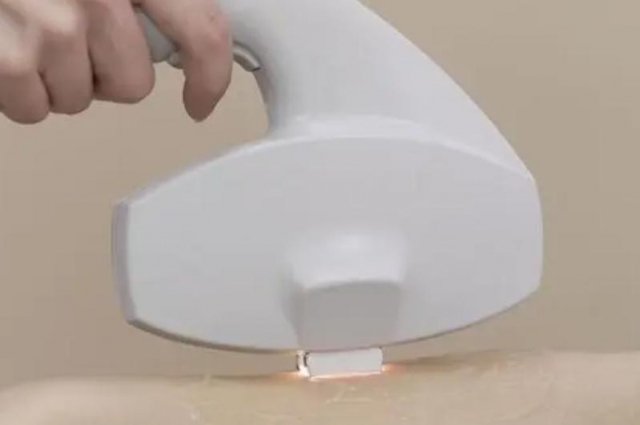 ��ʲôȥҸë ��ʲô����ȥҸë���^��