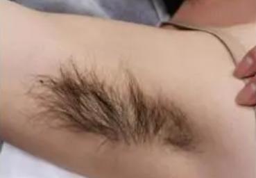 Ů��Ҹë̫������ʲôԭ�� Ҹë�ε����L�ø��ֆ�