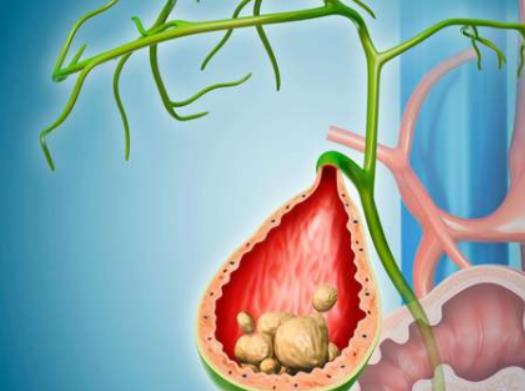 đ�Y(ji��)ʯ���u����Ӱ푆᣿��đ�Y(ji��)ʯđ�����ܲ��ܑ���