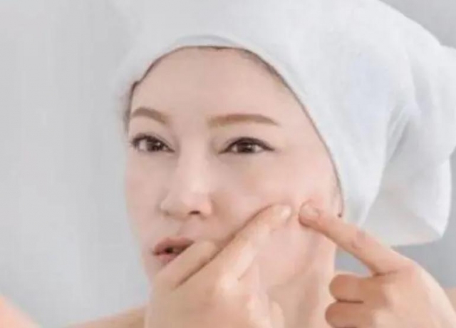 卸妝不徹底是否會引起皮膚痤瘡 眼唇卸妝液可以用來卸臉嗎 卸妝不徹底是否會引起皮膚痤瘡 眼唇卸妝液可以用來卸臉嗎