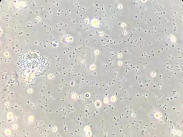 ֧ԭ�w���ײ�������ͨ�^ѪҺ��Ⱦ�� ֧ԭ�w��Ⱦ��ԭ������Щ