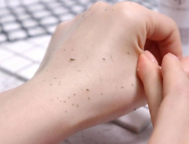 臉部長期不去角質會怎樣 去角質一周幾次最好 臉部長期不去角質會怎樣 去角質一周幾次最好