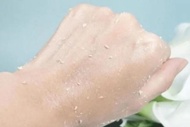 先去角質還是先用洗面奶 去角質層對皮膚有什么好處 先去角質還是先用洗面奶 去角質層對皮膚有什么好處