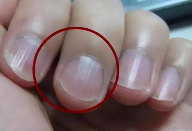 氣血不足是貧血嗎 氣血不足會導致奶水不足嗎 氣血不足是貧血嗎 氣血不足會導致奶水不足嗎