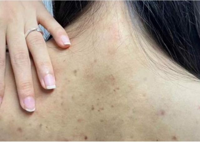 ���L������һЩ���η������] ���L��������������Æ�