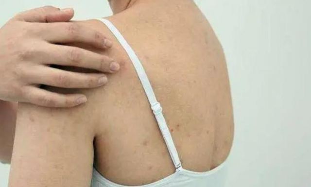 ���ϵĶ����L�˺ܾ�һֱ����ʧ �����L�������˶�������ô�k