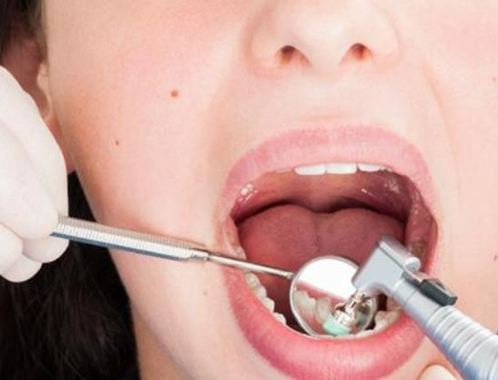 蛀牙疼怎么止疼?早晚刷牙哪個(gè)比較重要 蛀牙疼怎么止疼?早晚刷牙哪個(gè)比較重要