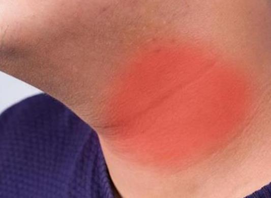 甲減患者不能熬夜嗎?甲減能去納米汗蒸嗎 甲減患者不能熬夜嗎?甲減能去納米汗蒸嗎