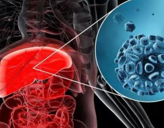 酒精肝繼續喝酒的后果是什么?酒精肝和乙肝哪個嚴重 酒精肝繼續喝酒的后果是什么?酒精肝和乙肝哪個嚴重